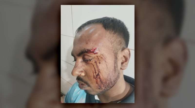 জমির সীমানা বিরোধে পরিকল্পিত হামলা